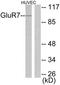 Glutamate Metabotropic Receptor 7 antibody, TA311811, Origene, Western Blot image 