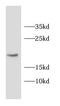Membrane attack complex inhibition factor antibody, FNab01489, FineTest, Western Blot image 