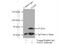Glutamate Decarboxylase 2 antibody, 20746-1-AP, Proteintech Group, Immunoprecipitation image 