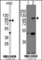 Cadherin 3 antibody, TA302124, Origene, Western Blot image 