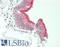 Desmoglein 4 antibody, LS-B13638, Lifespan Biosciences, Immunohistochemistry paraffin image 