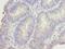 DNA Damage Inducible 1 Homolog 2 antibody, A65330-100, Epigentek, Immunohistochemistry paraffin image 