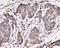 60S ribosomal protein L10 antibody, A04190-3, Boster Biological Technology, Immunohistochemistry paraffin image 