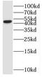 SH2 domain-containing protein 5 antibody, FNab07825, FineTest, Western Blot image 