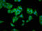 Dimethyladenosine transferase 1, mitochondrial antibody, LS-C672810, Lifespan Biosciences, Immunofluorescence image 