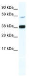 RELB Proto-Oncogene, NF-KB Subunit antibody, TA341809, Origene, Western Blot image 