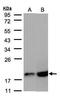 Cytochrome C Oxidase Subunit 4I1 antibody, TA308869, Origene, Western Blot image 