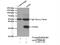KIR antibody, 13935-1-AP, Proteintech Group, Immunoprecipitation image 