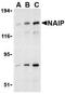 Baculoviral IAP repeat-containing protein 1 antibody, TA306166, Origene, Western Blot image 