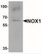 NADPH Oxidase 1 antibody, NBP2-41290, Novus Biologicals, Western Blot image 