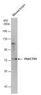 Phosphatase And Actin Regulator 1 antibody, GTX131152, GeneTex, Western Blot image 