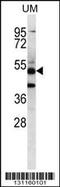 Pancreatic Lipase Related Protein 3 antibody, 56-644, ProSci, Western Blot image 