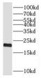 SFT2 Domain Containing 3 antibody, FNab07795, FineTest, Western Blot image 