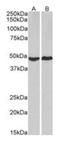 cAMP-dependent protein kinase catalytic subunit alpha antibody, orb334051, Biorbyt, Western Blot image 
