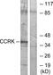 CDK-related protein kinase PNQLARE antibody, A30522, Boster Biological Technology, Western Blot image 