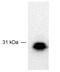 F-Box Protein 44 antibody, TA301558, Origene, Western Blot image 