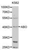 ABO, Alpha 1-3-N-Acetylgalactosaminyltransferase And Alpha 1-3-Galactosyltransferase antibody, abx001336, Abbexa, Western Blot image 