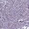 Arginine And Serine Rich Coiled-Coil 1 antibody, PA5-60828, Invitrogen Antibodies, Immunohistochemistry frozen image 