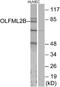 Noelin antibody, A07745, Boster Biological Technology, Western Blot image 