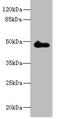Zinc Finger Protein 232 antibody, A61938-100, Epigentek, Western Blot image 