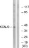 Potassium Voltage-Gated Channel Subfamily J Member 9 antibody, LS-B7260, Lifespan Biosciences, Western Blot image 
