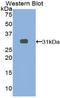 Leucine Rich Repeats And Immunoglobulin Like Domains 3 antibody, LS-C295131, Lifespan Biosciences, Western Blot image 