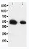 Solute carrier family 2, facilitated glucose transporter member 8 antibody, LS-C313271, Lifespan Biosciences, Western Blot image 
