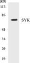 Spleen Associated Tyrosine Kinase antibody, EKC1553, Boster Biological Technology, Western Blot image 
