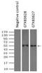 Solute Carrier Family 2 Member 5 antibody, GTX83627, GeneTex, Immunoprecipitation image 