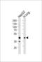 MOK Protein Kinase antibody, LS-C162421, Lifespan Biosciences, Western Blot image 
