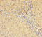 Alcohol Dehydrogenase 1B (Class I), Beta Polypeptide antibody, A54784-100, Epigentek, Immunohistochemistry paraffin image 