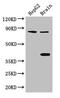 Fidgetin, Microtubule Severing Factor antibody, CSB-PA008676LA01HU, Cusabio, Western Blot image 