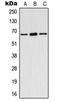 Estrogen Receptor 1 antibody, LS-C352205, Lifespan Biosciences, Western Blot image 