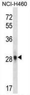 Fibroblast growth factor 10 antibody, AP51653PU-N, Origene, Western Blot image 
