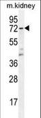 Thromboxane A Synthase 1 antibody, LS-C167244, Lifespan Biosciences, Western Blot image 
