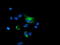 Protein Phosphatase 1 Regulatory Subunit 15A antibody, TA504313, Origene, Immunofluorescence image 