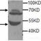 ADAM Metallopeptidase With Thrombospondin Type 1 Motif 5 antibody, TA310094, Origene, Western Blot image 