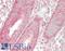 Ribosomal Protein L35 antibody, LS-B14695, Lifespan Biosciences, Immunohistochemistry paraffin image 