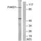 FAST Kinase Domains 1 antibody, A13678, Boster Biological Technology, Western Blot image 