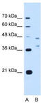 Ecotropic Viral Integration Site 2B antibody, TA341843, Origene, Western Blot image 