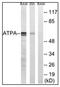 ATP Synthase F1 Subunit Alpha antibody, AP31337PU-N, Origene, Western Blot image 