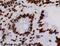 Heterogeneous nuclear ribonucleoproteins A2/B1 antibody, ab6102, Abcam, Immunohistochemistry paraffin image 