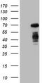 Colony Stimulating Factor 1 antibody, CF806556, Origene, Western Blot image 