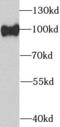 Argonaute RISC Catalytic Component 2 antibody, FNab00214, FineTest, Western Blot image 