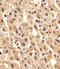 Phosphoglucomutase-1 antibody, M02318, Boster Biological Technology, Immunohistochemistry paraffin image 