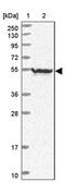 Zinc finger protein neuro-d4 antibody, PA5-61895, Invitrogen Antibodies, Western Blot image 
