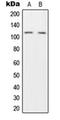Hepatocyte Growth Factor-Regulated Tyrosine Kinase Substrate antibody, orb224052, Biorbyt, Western Blot image 