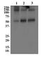 Solute Carrier Family 1 Member 3 antibody, NB100-1869, Novus Biologicals, Western Blot image 