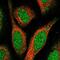Spermatogenesis Associated 24 antibody, NBP1-92429, Novus Biologicals, Immunocytochemistry image 