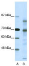 SMRT antibody, TA330552, Origene, Western Blot image 